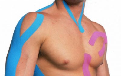 Kinesiotaping o vendas de colores ¿cómo funciona y por qué se usa en Fisioterapia?